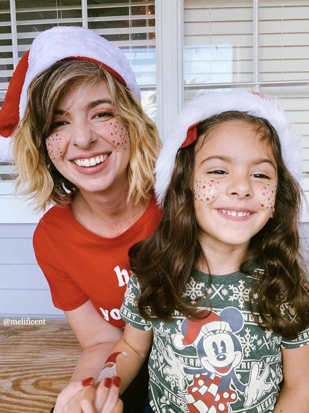 Christmas freckles