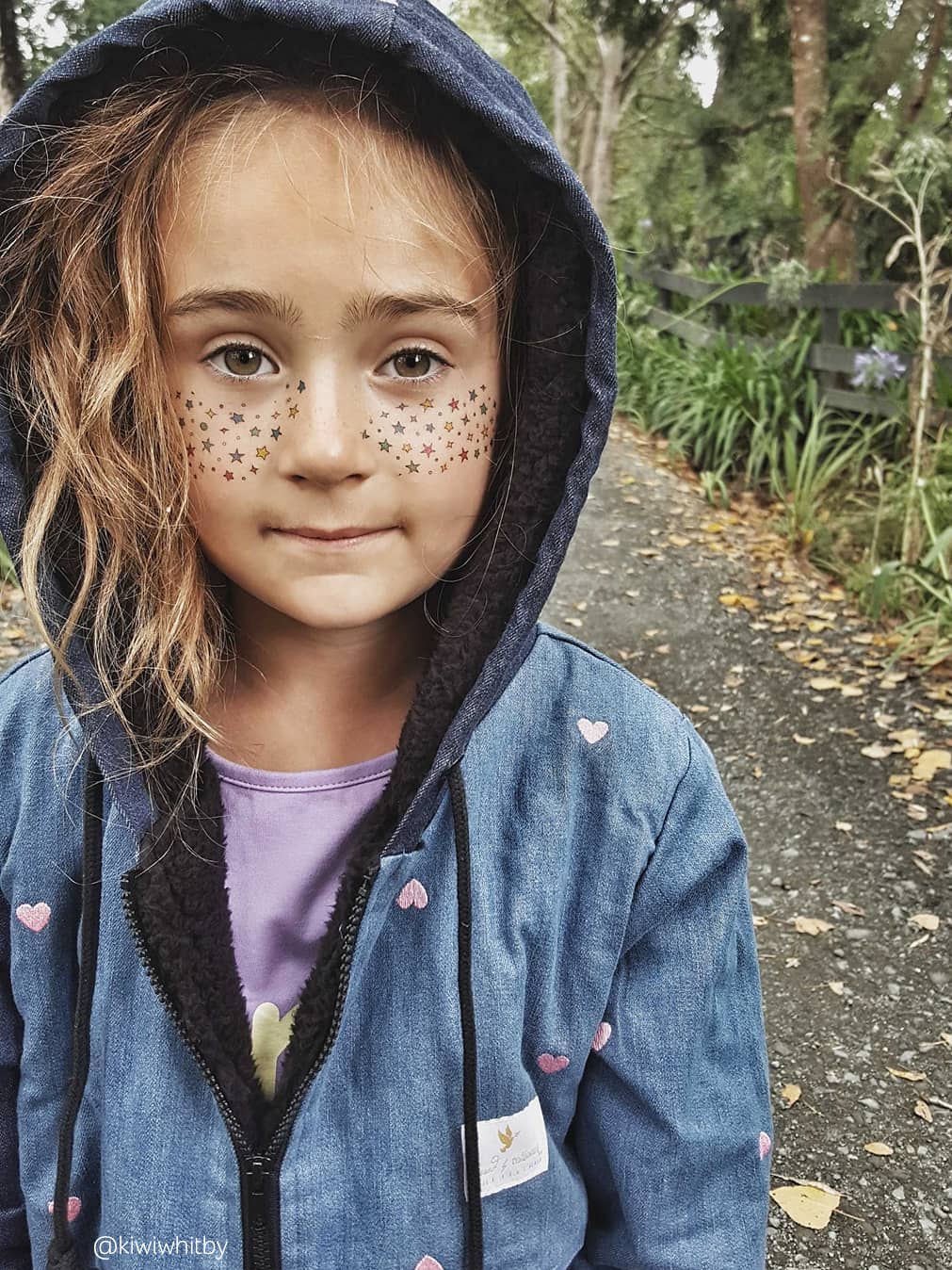 Star freckles